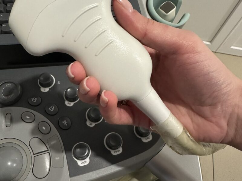 Апарат УЗД Siemens ACUSON S2000 (2013 рік)