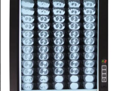 Світлодіодний медичний негатоскоп WL-1D