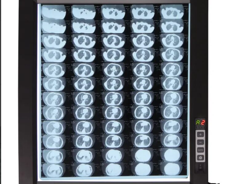 Світлодіодний медичний негатоскоп WL-1D