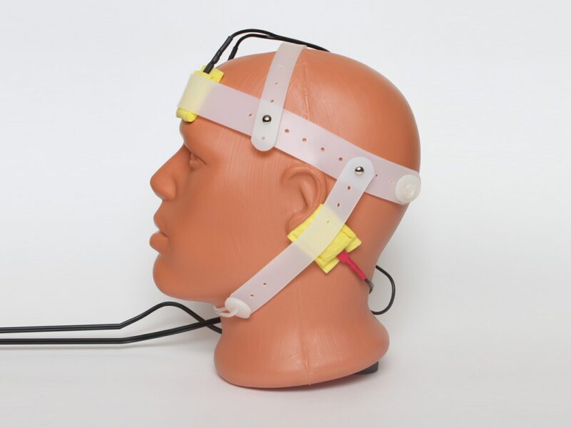 Нозологічний електродний трафарет №2