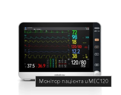 Монітор пацієнта uMEC120