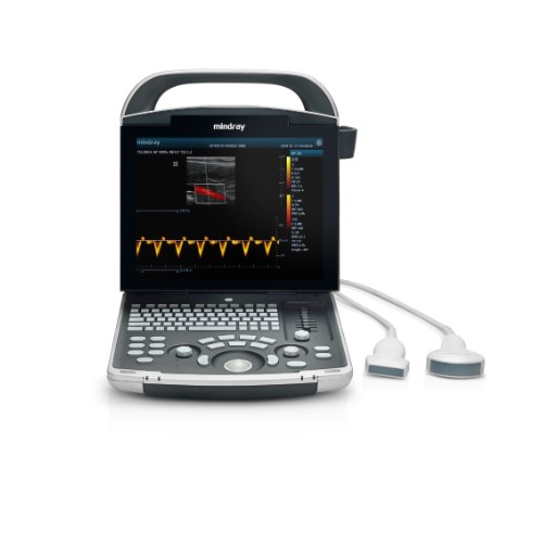 Система ультразвукова діагностична Mindray DP-30
