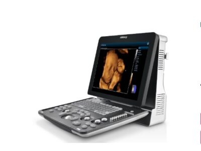 Cистема ультразвукова діагностична Mindray Z60